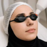 عینک لیزر موهای زائد بدن بر روی صورت یک خانم در کیلینیک مرقابت های پوستی
